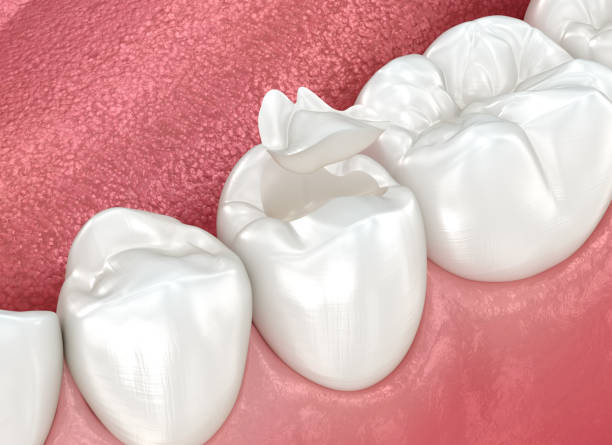 Best Dental Fillings (Composite and Amalgam)  in Golden Triangle, NJ